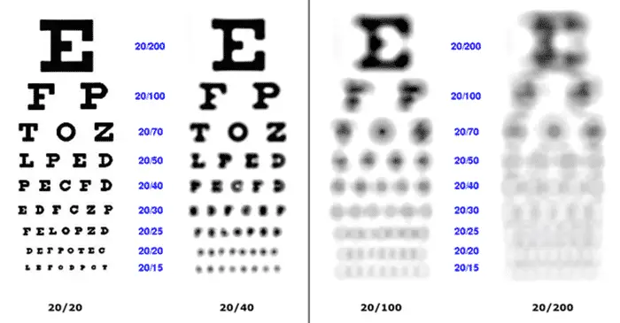 Snellen Göz Testi 