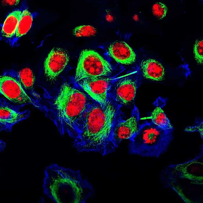 Henrietta Lacks ve Onun Ölümsüz HeLa Hücreleri