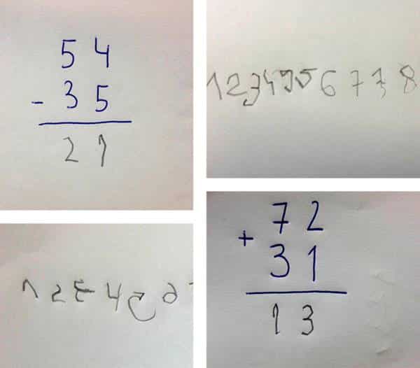 Diskalkuli Yani Matematik Öğrenme Güçlüğü Nedir?