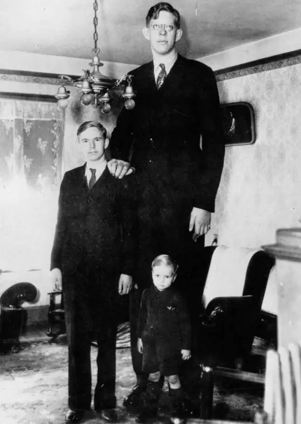 Dünyanın En Uzun İnsanı Robert Wadlow Neden Bu Kadar Uzadı?