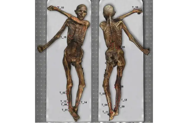 Buz Adam Ötzi Dövmeleri Ne Amaçla Yapılmıştı?