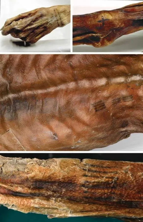 Buz Adam Ötzi'nin Dövmeleri Ne Amaçla Yapılmıştı?